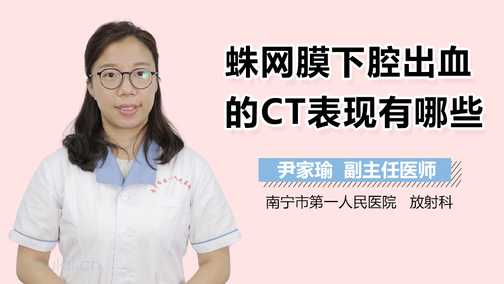 蛛网膜下腔出血的CT表现有哪些