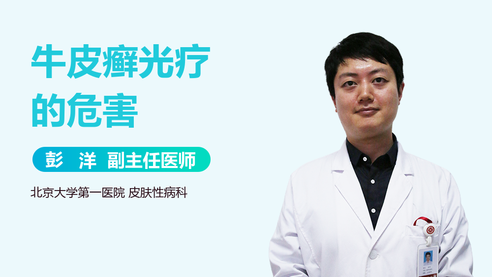 牛皮癣光疗的危害