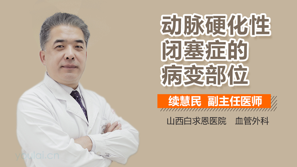 动脉硬化性闭塞症的病变部位