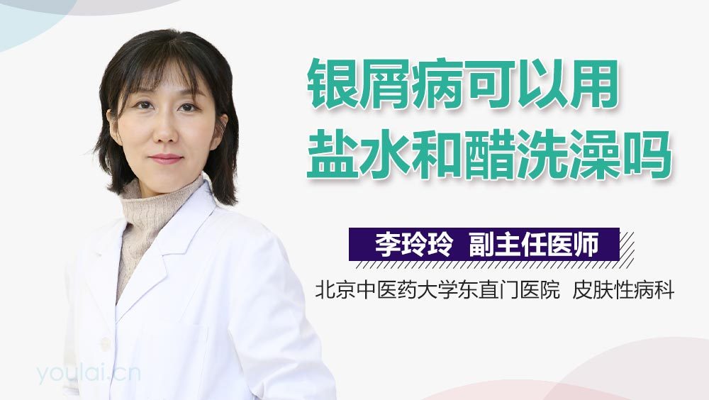 银屑病可以用盐水和醋洗澡吗