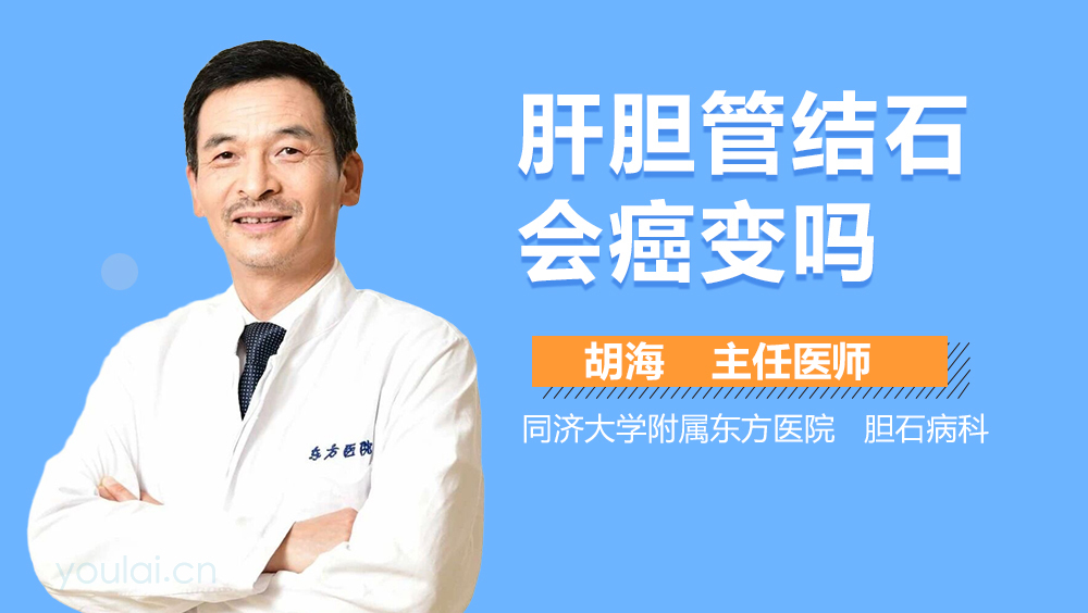 肝胆管结石会癌变吗