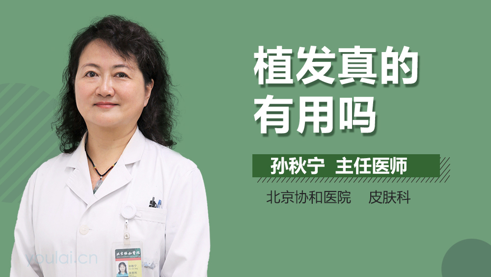 植发真的有用吗