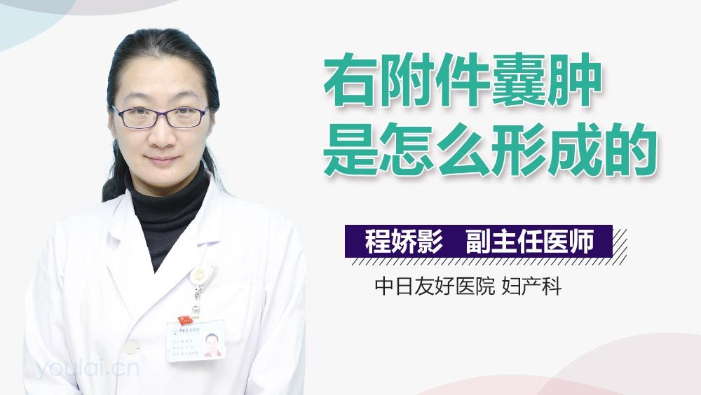 右附件囊肿是怎么形成的