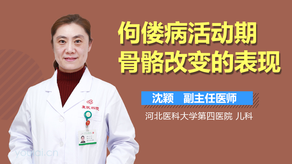 佝偻病活动期骨骼改变的表现