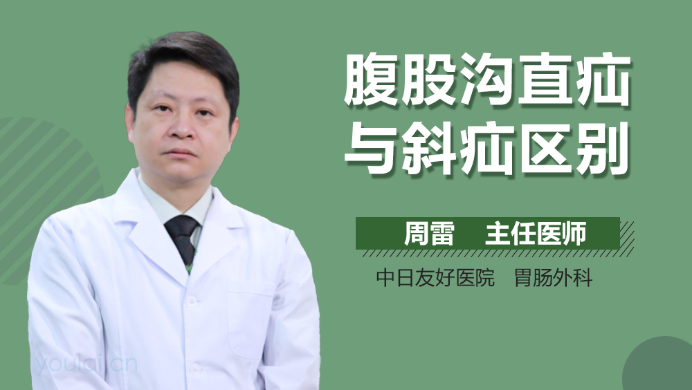 腹股沟直疝与斜疝区别