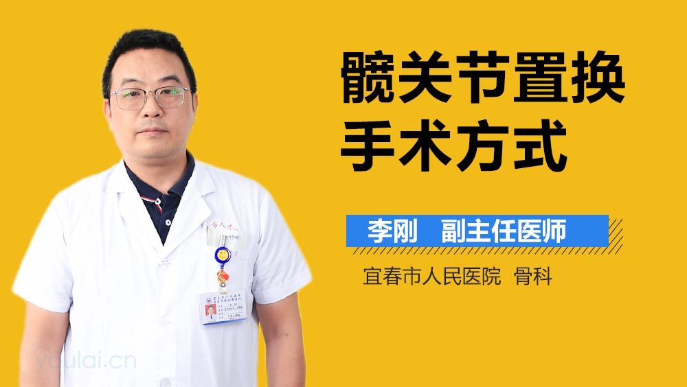 髋关节置换手术方式