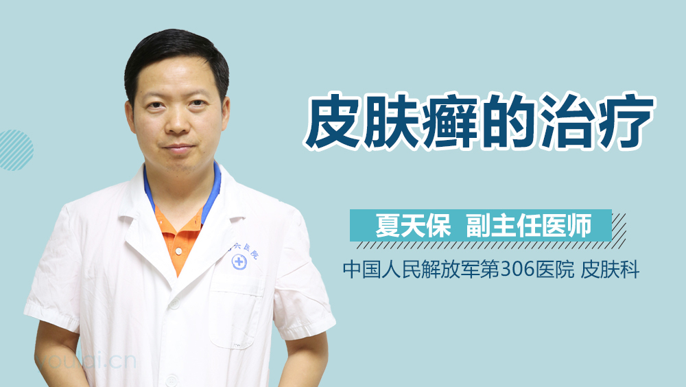 皮肤癣的治疗