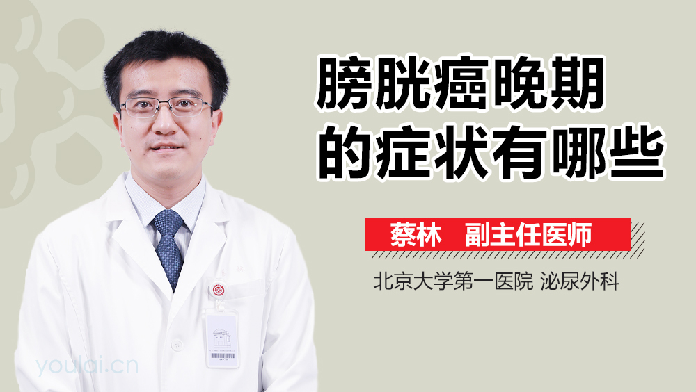 膀胱癌晚期的症状有哪些