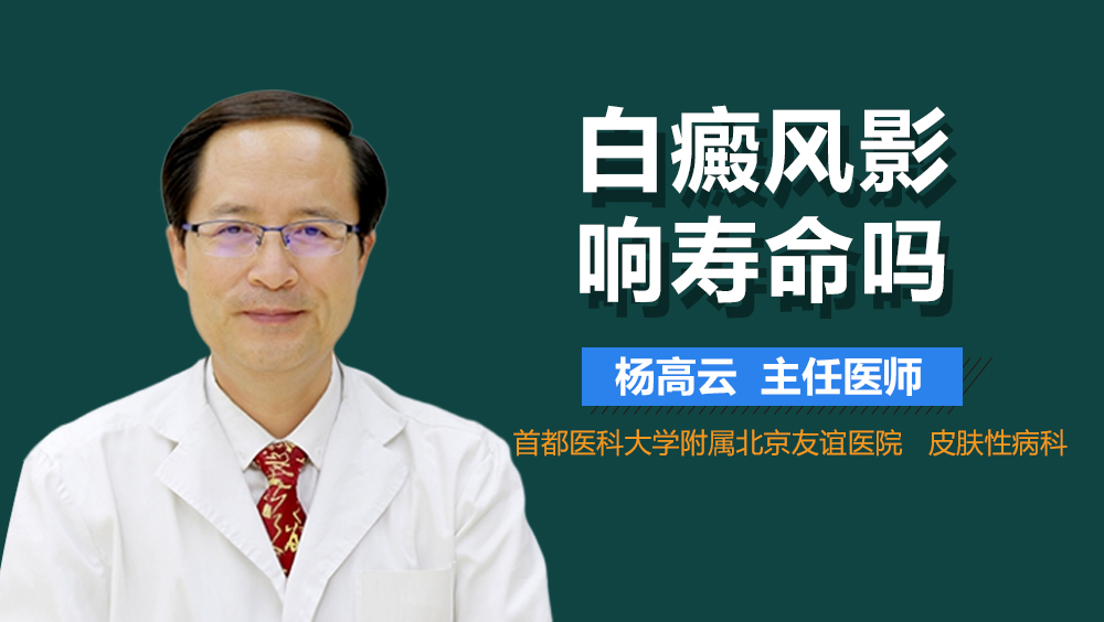 白癜风影响寿命吗