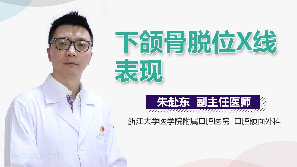 下颌骨脱位X线表现