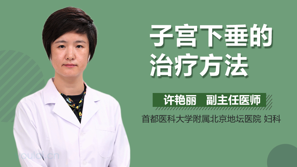 子宫下垂的治疗方法