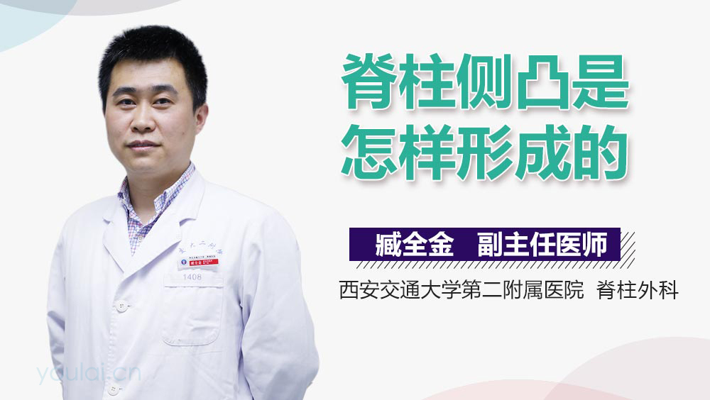 脊柱侧凸是怎样形成的