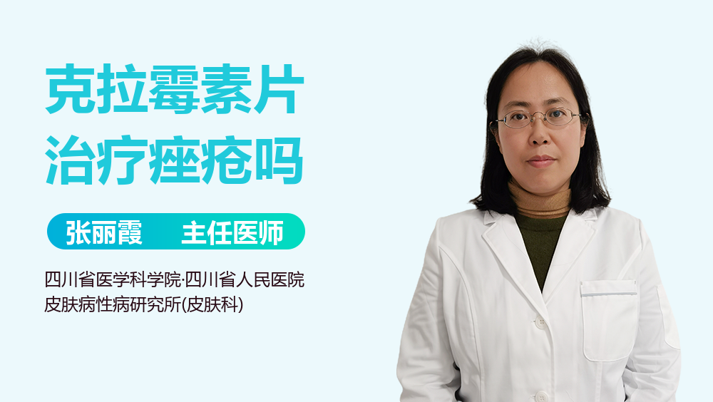 克拉霉素片治疗痤疮吗