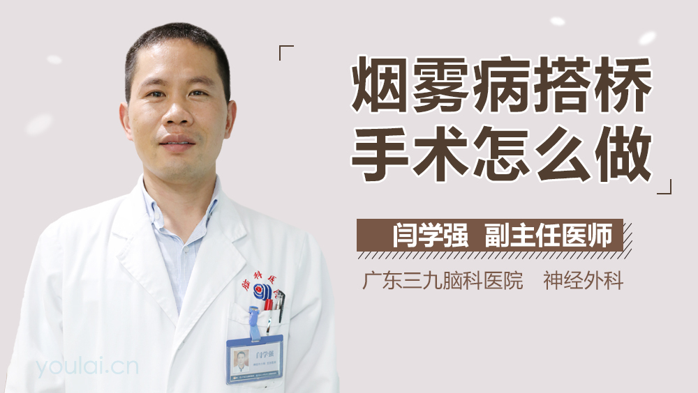 烟雾病搭桥手术怎么做