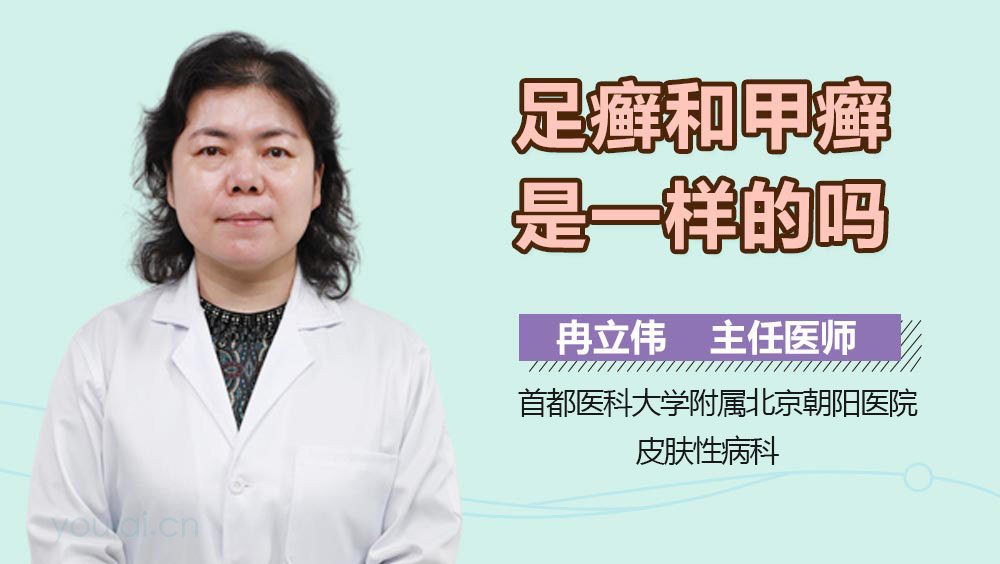 足癣和甲癣是一样的吗