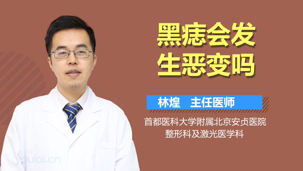 黑痣会发生恶变吗