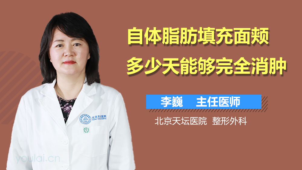 自体脂肪填充面颊多少天能够完全消肿