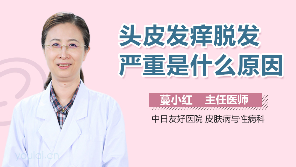 头皮发痒脱发严重是什么原因