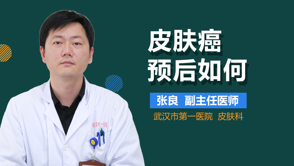 皮肤癌预后如何