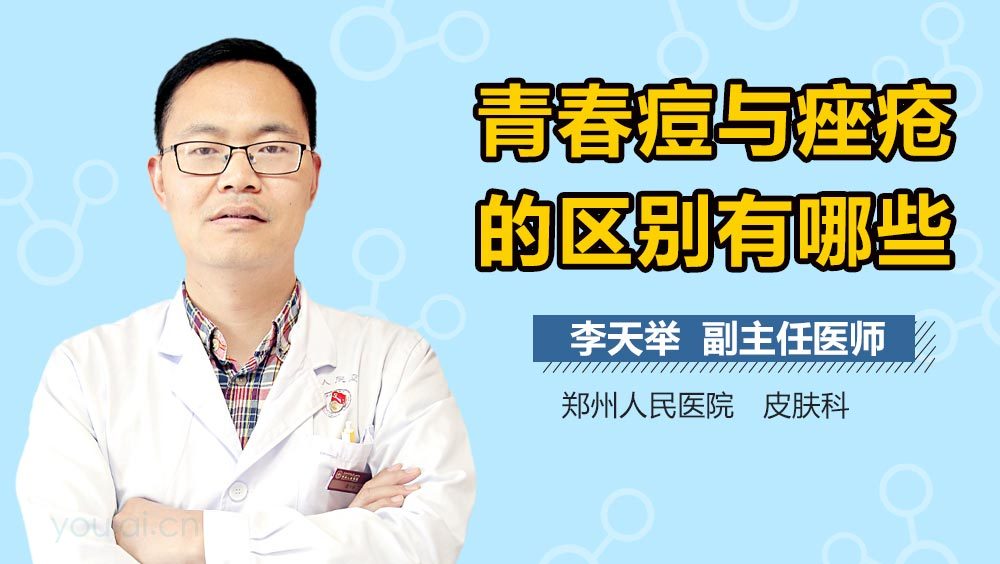 青春痘与痤疮的区别有哪些