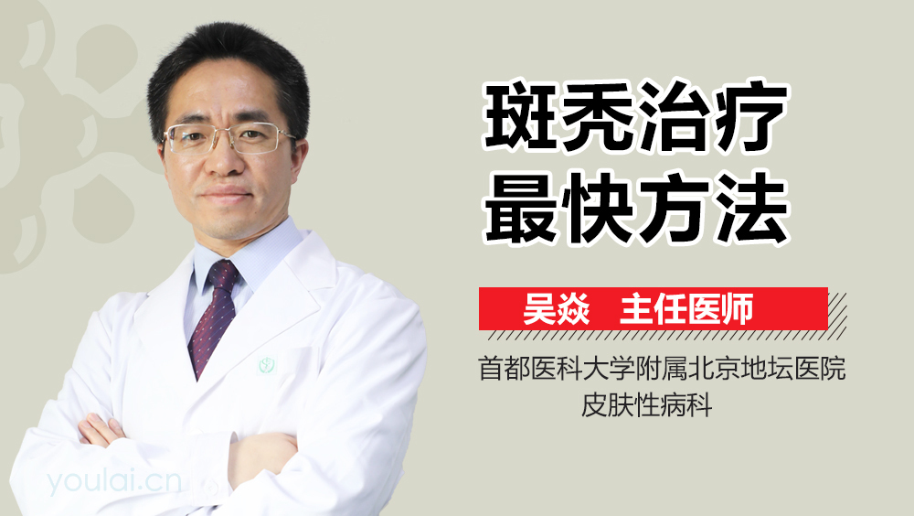 斑秃治疗最快方法