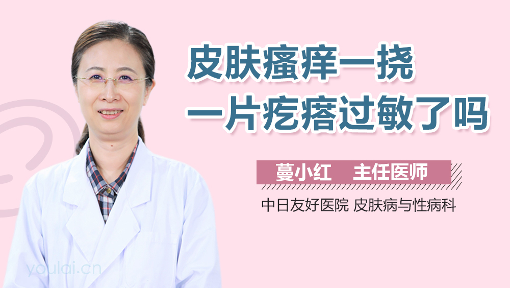 皮肤瘙痒一挠一片疙瘩过敏了吗