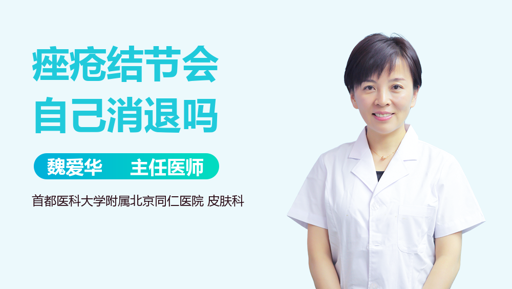 痤疮结节会自己消退吗