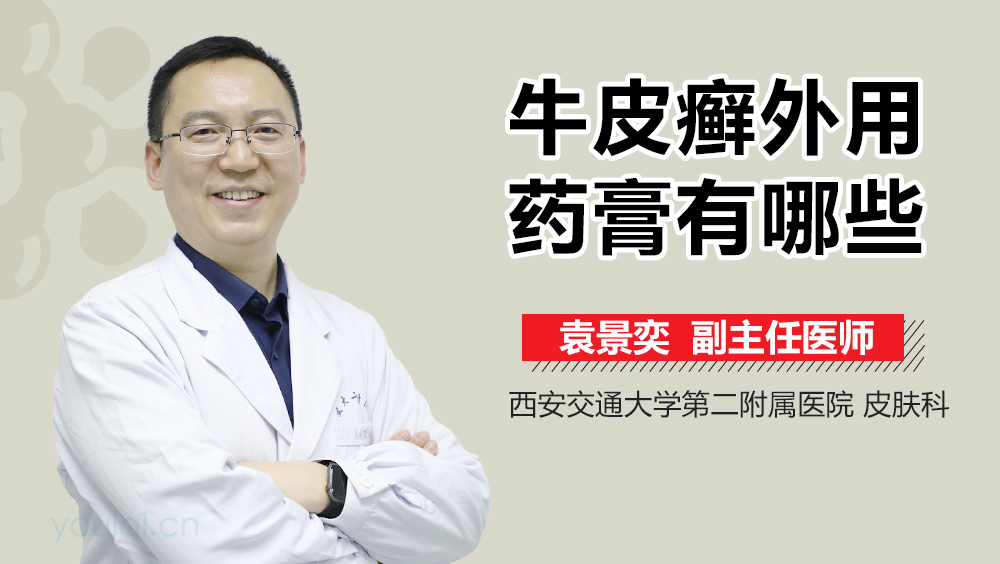 牛皮癣外用药膏有哪些