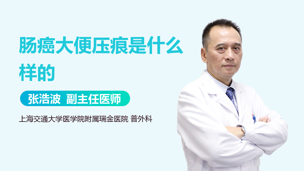 肠癌大便压痕是什么样的