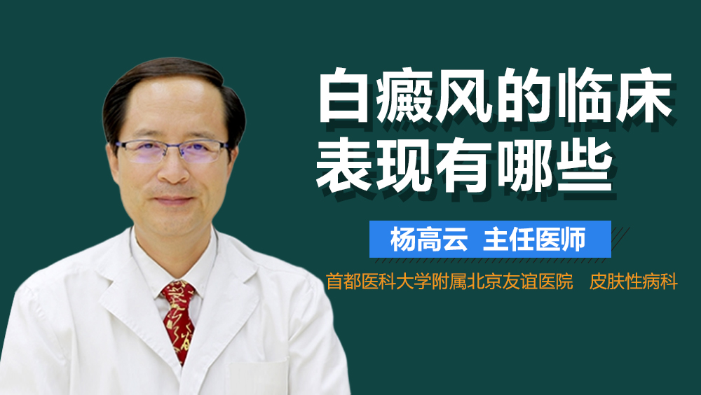 白癜风的临床表现有哪些