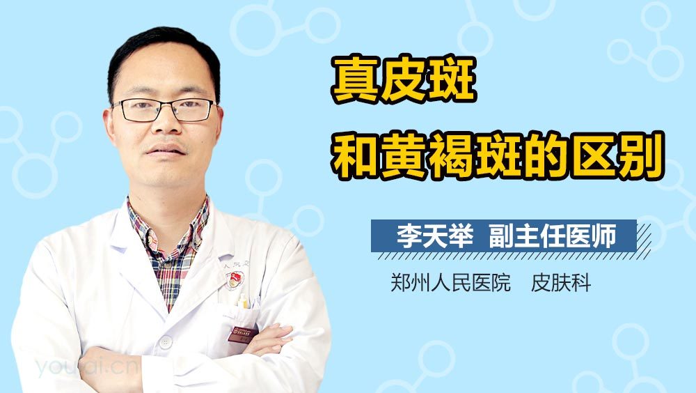 真皮斑和黄褐斑的区别