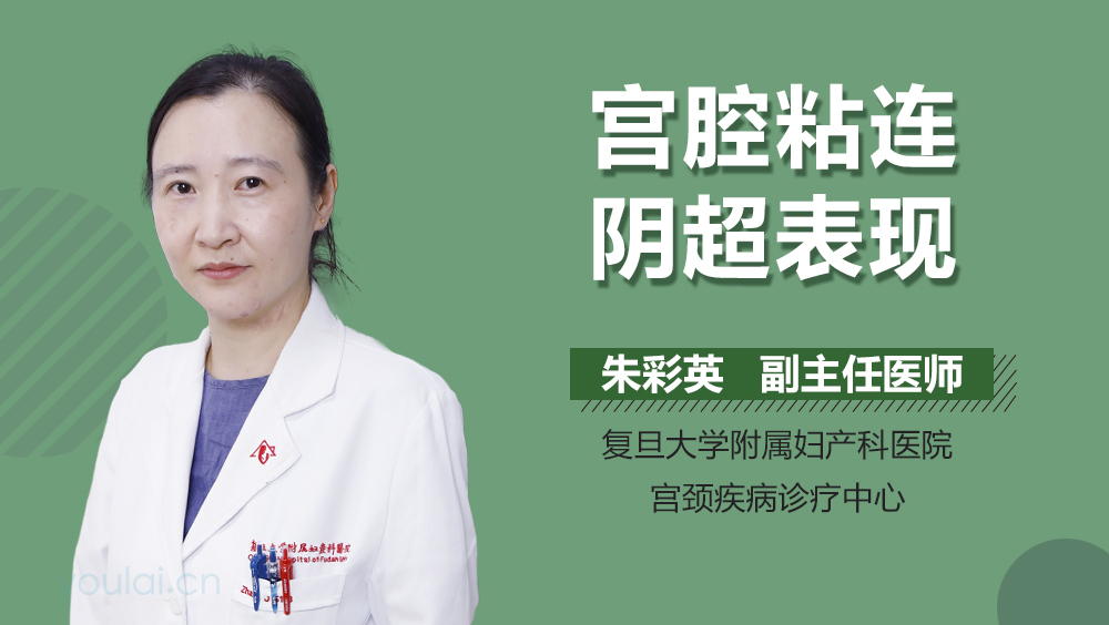 宫腔粘连阴超表现