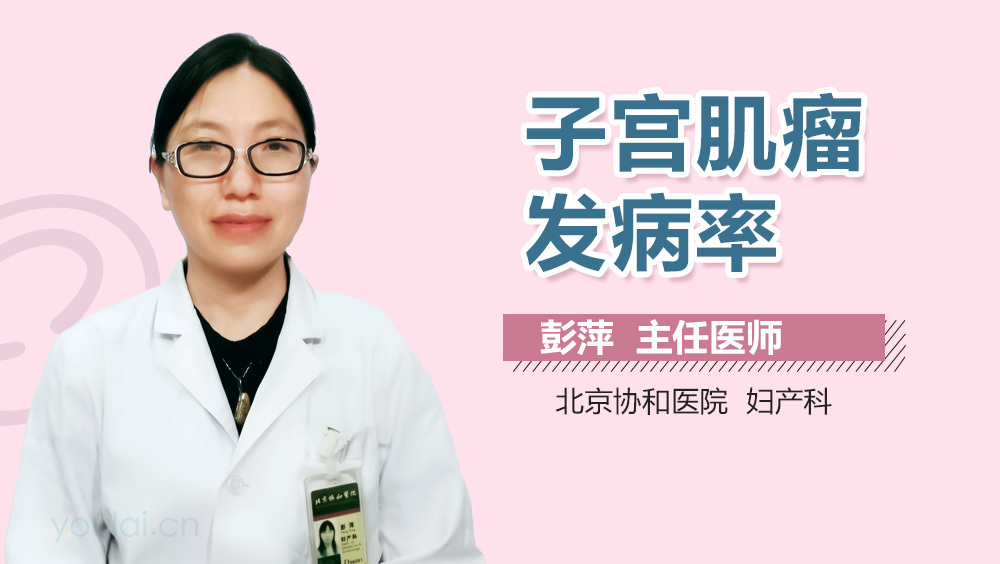 子宫肌瘤发病率