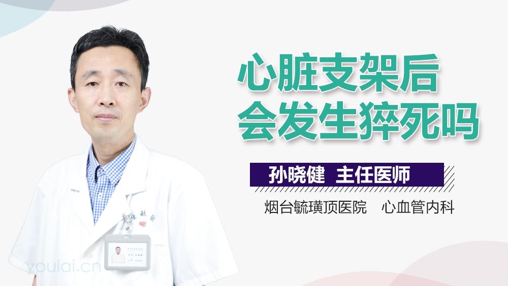 心脏支架后会发生猝死吗