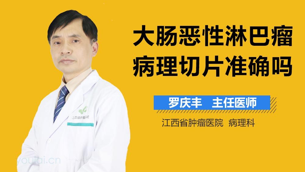 大肠恶性淋巴瘤病理切片准确吗