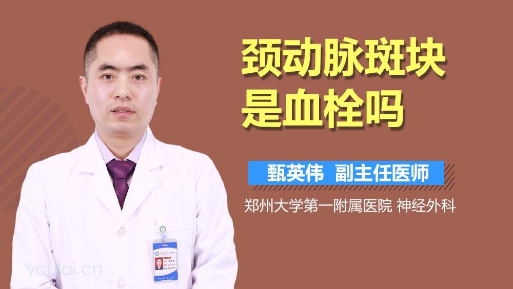 颈动脉斑块是血栓吗