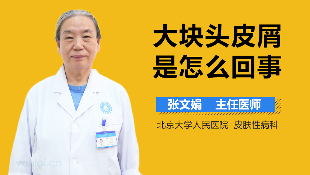 大块头皮屑是怎么回事