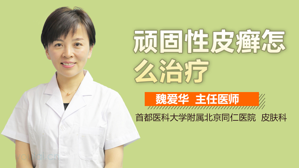 顽固性皮癣怎么治疗