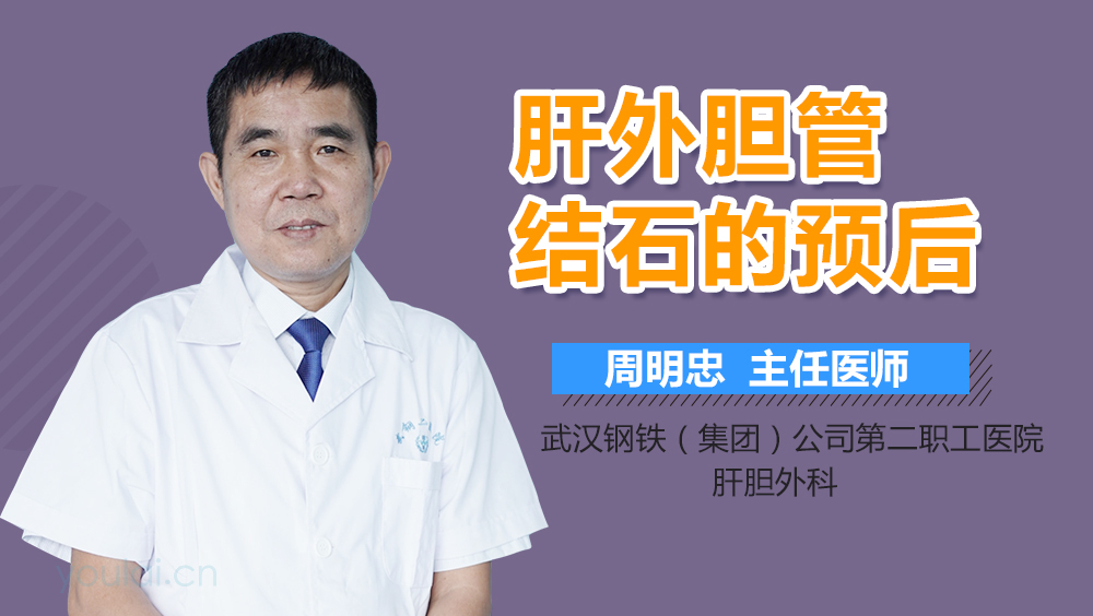 肝外胆管结石的预后