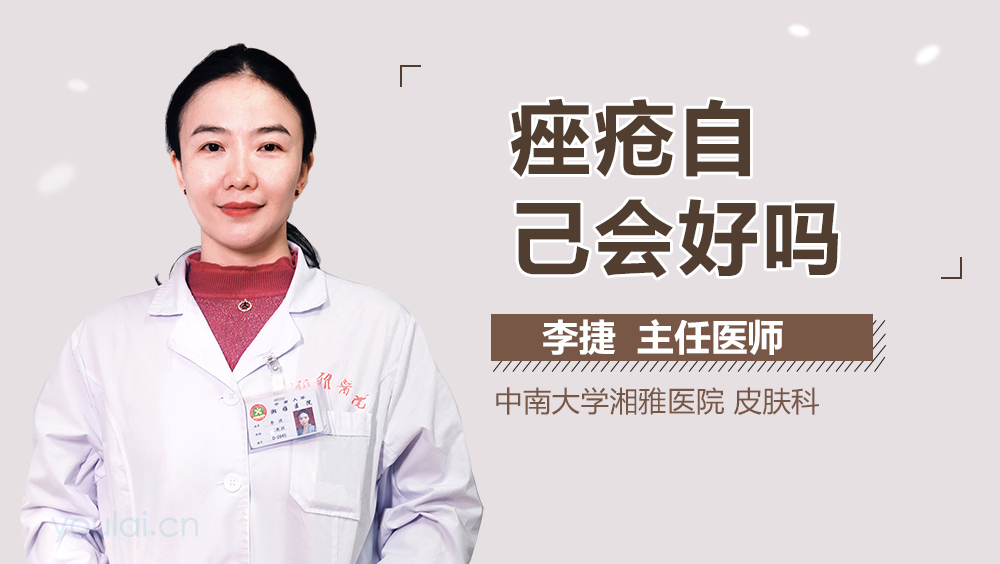 痤疮自己会好吗