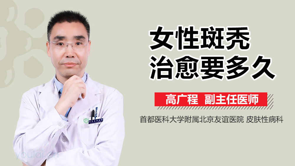 女性斑秃治愈要多久