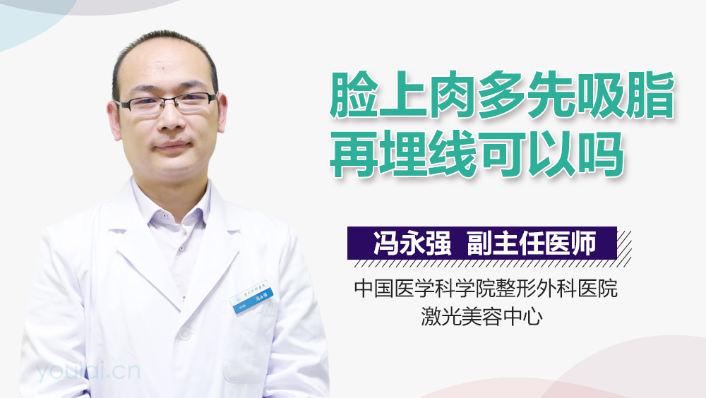 脸上肉多先吸脂再埋线可以吗
