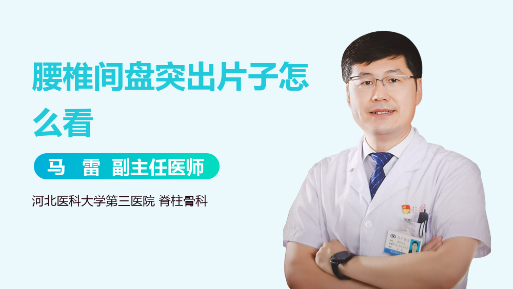 腰椎间盘突出片子怎么看