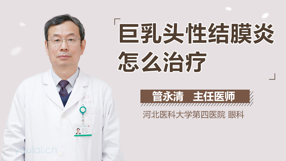 巨乳头性结膜炎怎么治疗