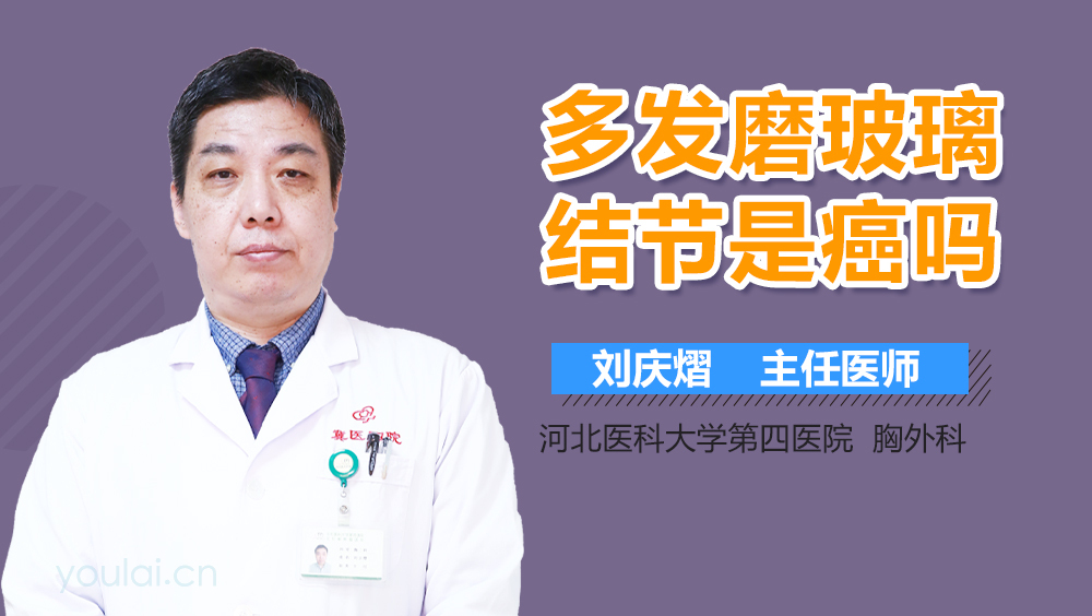 多发磨玻璃结节是癌吗