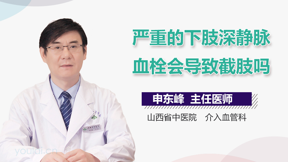 严重的下肢深静脉血栓会导致截肢吗