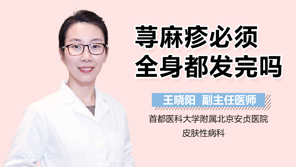 荨麻疹必须全身都发完吗