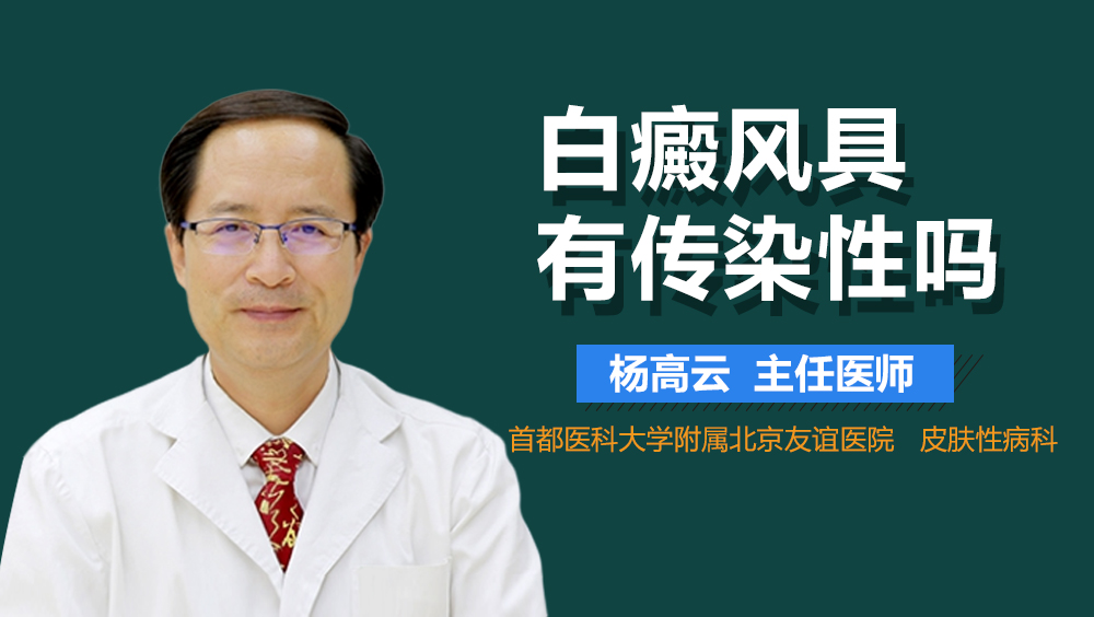 白癜风具有传染性吗