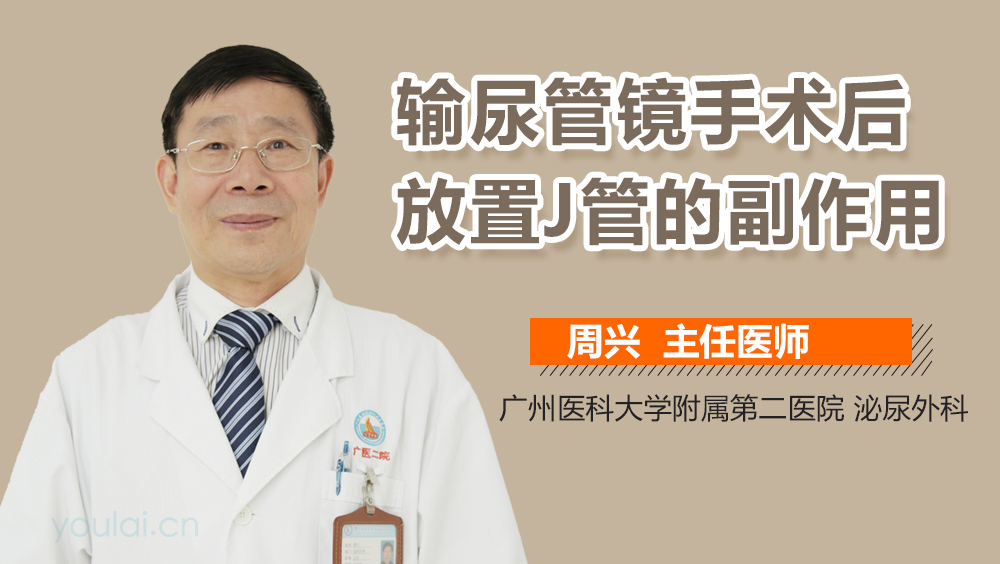 输尿管镜手术后放置J管的副作用