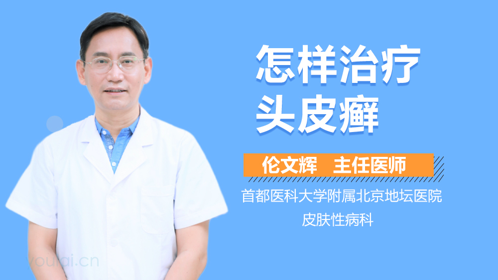 怎样治疗头皮癣